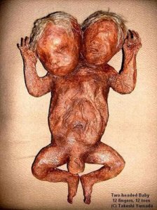 two-headed-baby
